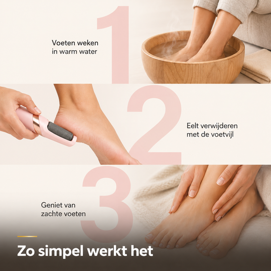 Elektrische Eeltverwijderaar – Voor zijdezachte voeten zonder salon